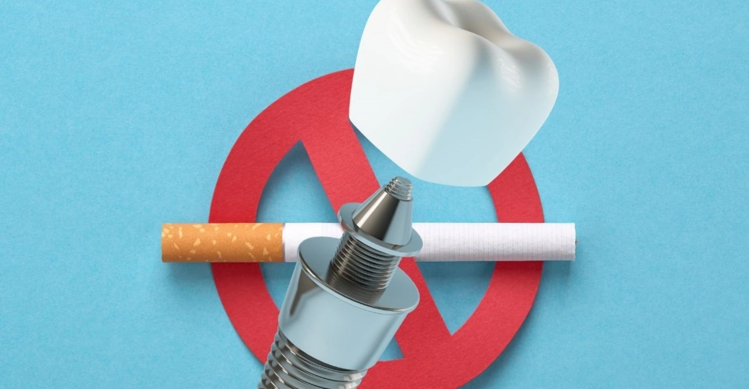 Can Smokers Get Dental Implants1